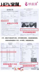 37岁，感染HPV高危39型，且
